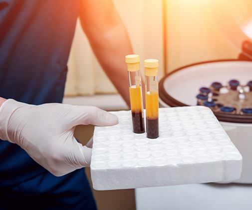 Blood and plasma separated in test tube